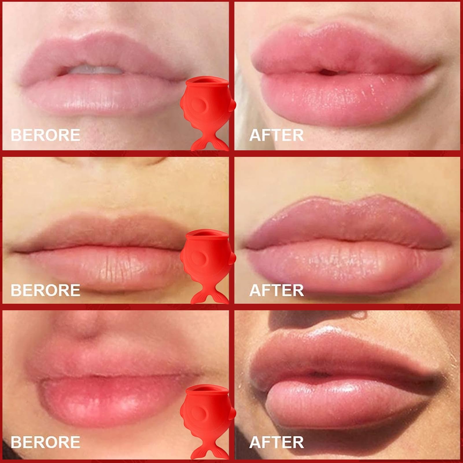 Fish Shape Lip Plumper Tool - Silicone Lip Enhancer for Fuller, Sexy Lips - Natural Pout & Moisturizing Care - Self-Suction Plumping Device for Kissable Lips (Perfect for Date Night & Self-Care Routine)