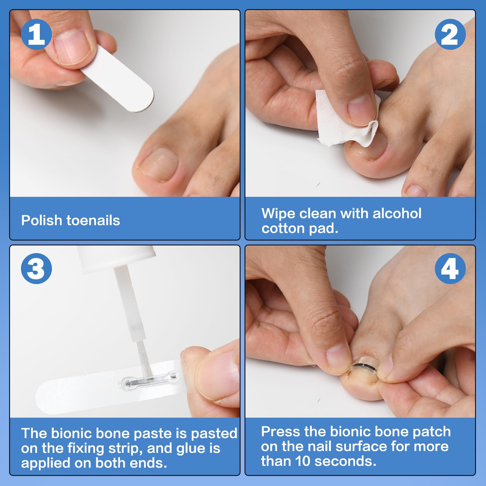 Professional Ingrown Toenail Removal Kit - Titanium Alloy Toenail Corrector Tool for Pain Relief & Home Treatment (0.75-0.82 Inch) - Perfect for Athletes, Runners & Daily Foot Care