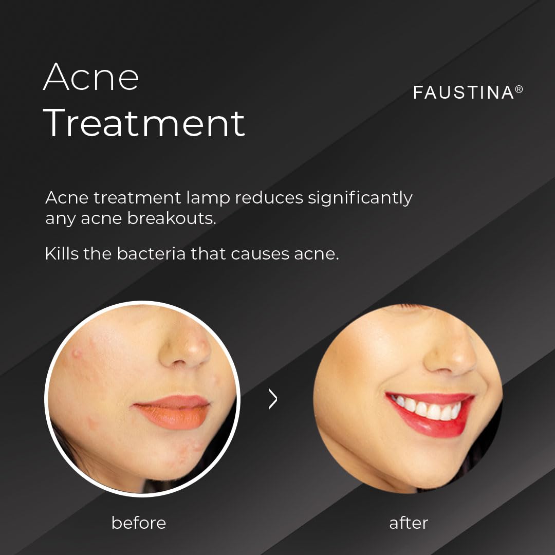 FAUSTINA 2,000,000 Flashes IPL Hair Removal Device for Women & Men - Permanent Laser Hair Removal at Home, Skin Rejuvenation & Acne Treatment - Includes Free Pouch & UV Protection Glasses - Perfect for Face, Legs, Underarms & Bikini Line