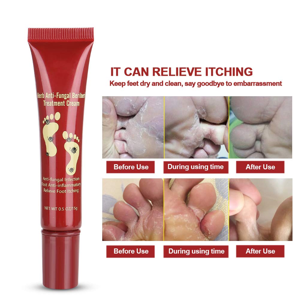 15g Natural Plant Foot Care Cream - Moisturizing Ointment for Fungal Relief & Cracked Heels | Ideal for Athletes, Diabetics & Daily Foot Care