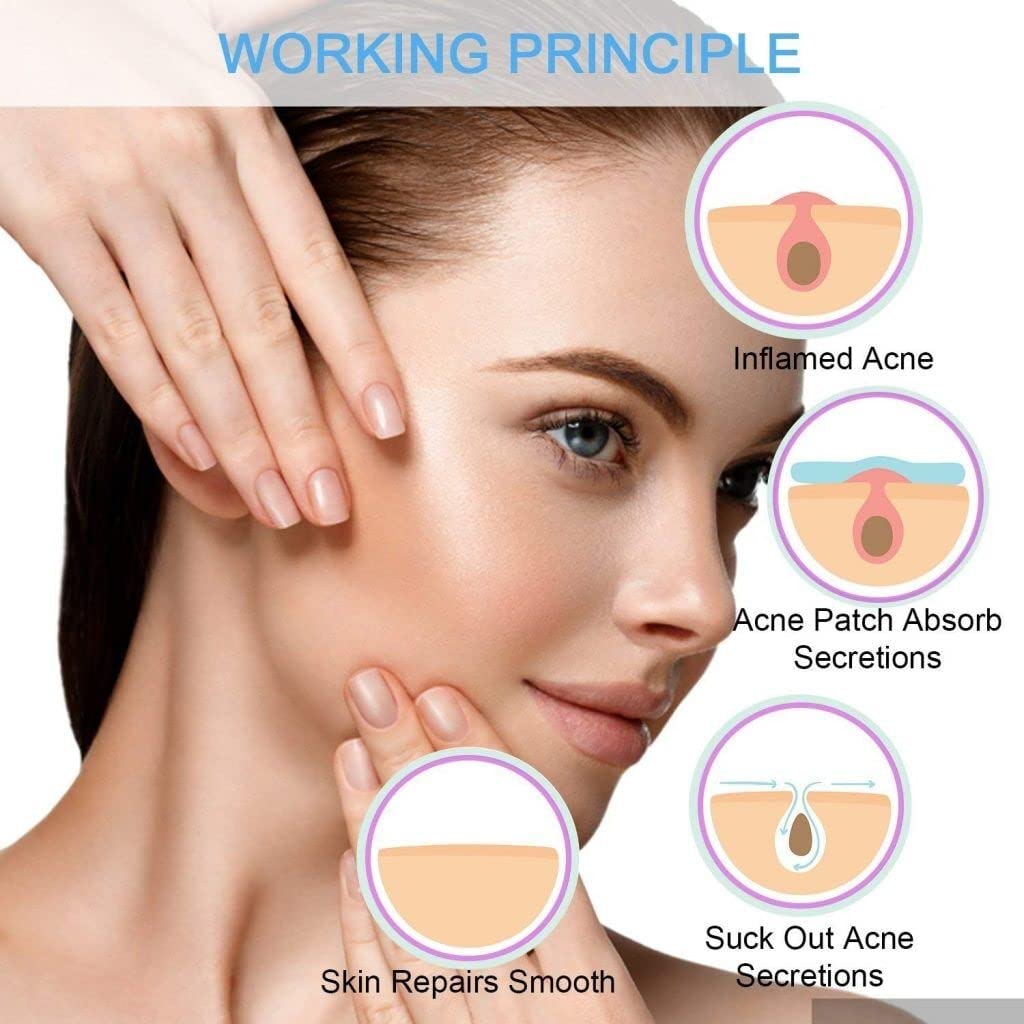 PSM100 Hydrocolloid Acne Patches for Face - Disposable Pimple Patch for Men & Women (2 Sizes) - Treats Cystic Acne & Whiteheads - Perfect for Overnight Spot Treatment & Daily Skincare Routine