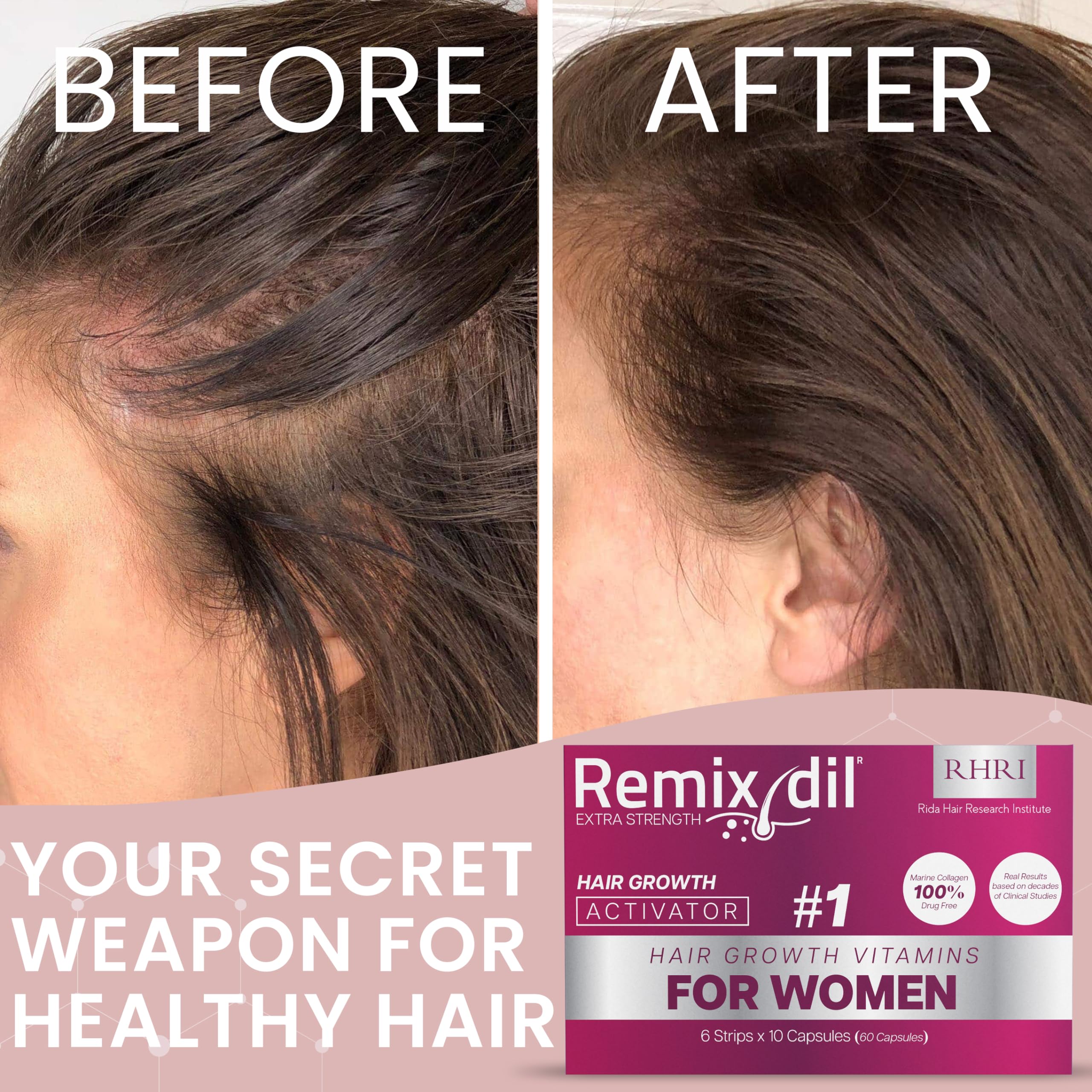 Best Hair Growth Vitamins for Women - Biotin & Collagen Supplement for Thicker, Stronger Hair & Hair Loss Treatment - Perfect for Daily Use & Healthy Hair Care Routine