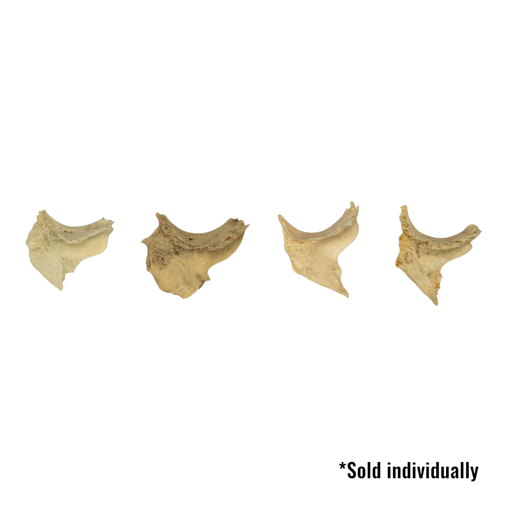 Authentic Human Zygomatic Bone - Single Specimen for Medical Study, Anatomy Education & Forensic Research | Ideal for Medical Students, Doctors & Science Enthusiasts