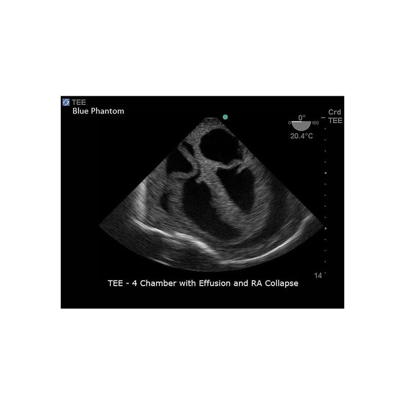 FAST Exam Ultrasound Training Model - Transthoracic & Transesophageal Echo Simulator for Cardiac Sonography Practice (Ideal for Medical Students, Ultrasound Tech Training & Clinical Skills Development)