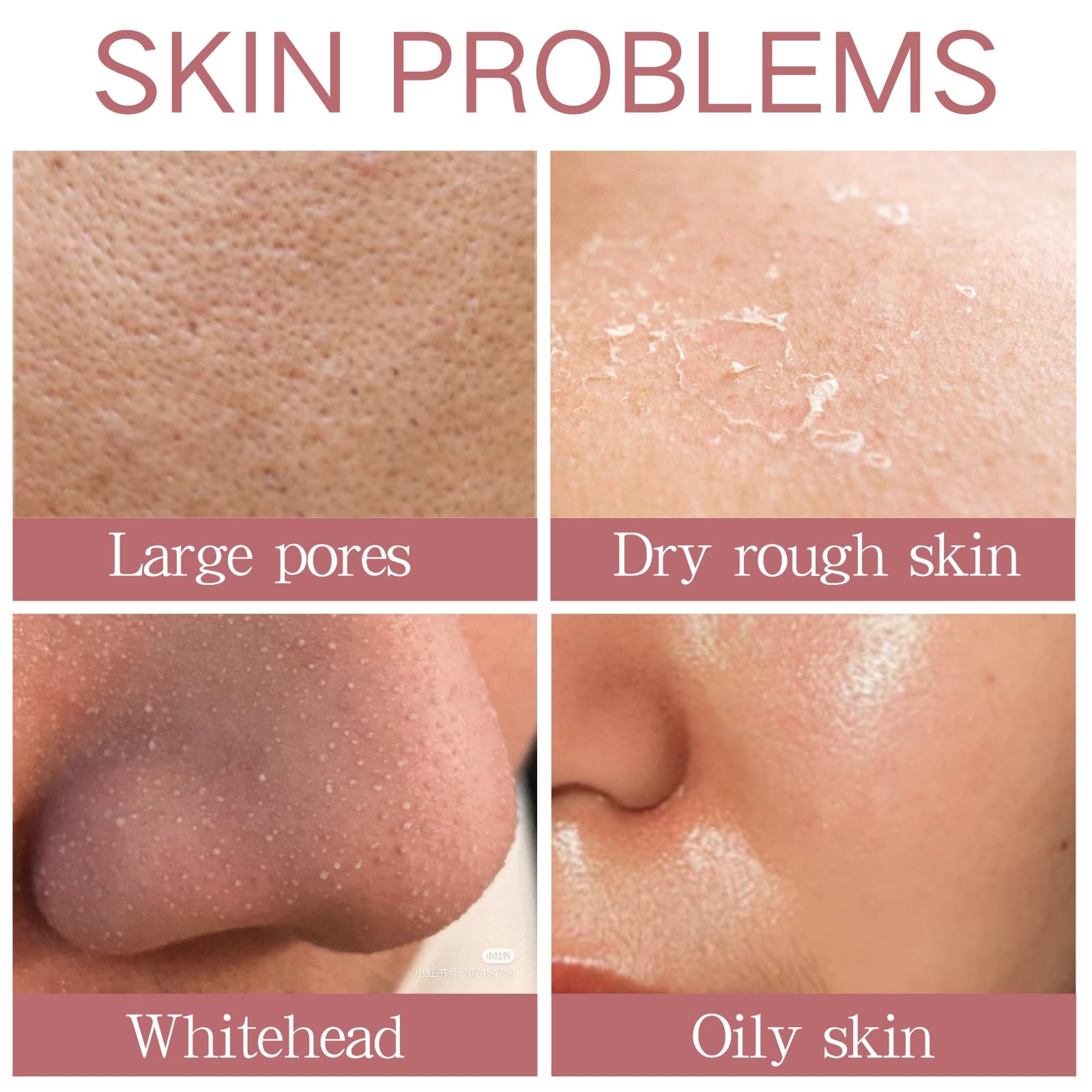 2 Pcs Purifying Exfoliating Gel - Gentle Face & Body Scrub for Sensitive Skin - Pore Minimizer & Whitehead Remover - Deep Cleansing & Moisturizing Gel for Acne-Prone Skin - Perfect for Daily Skincare Routine & Spa Treatment at Home