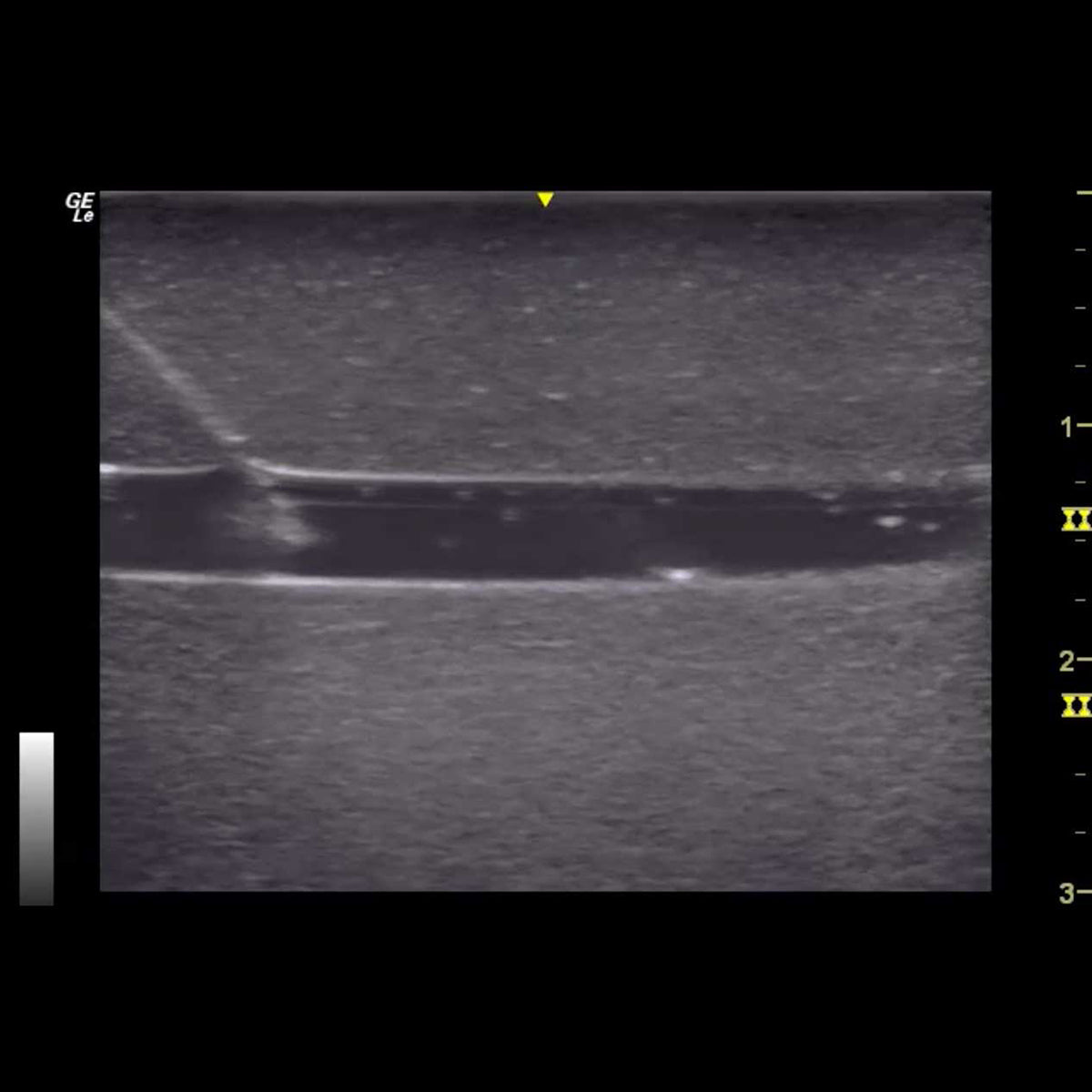 HM2.0 Remoldable 2-Vessel Ultrasound Training Model - Perfect for Medical Students & Sonography Practice (Arterial & Venous Vessel Simulation)