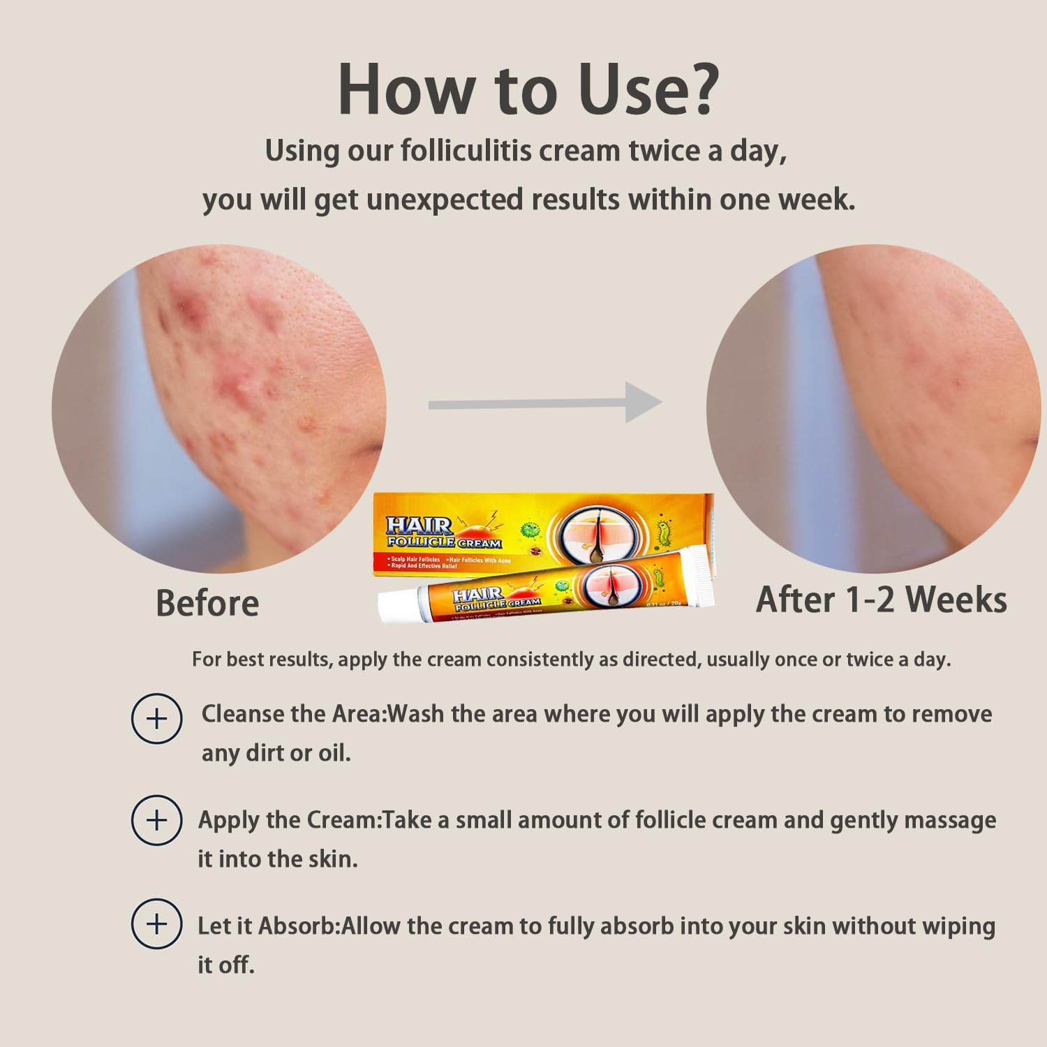 TKTT Folliculitis Treatment Cream - Professional Medicated Cream for Scalp, Body & Face Folliculitis Relief - 20g x 2 Tubes - Soothes Itchy, Inflamed Skin at Home & On-The-Go