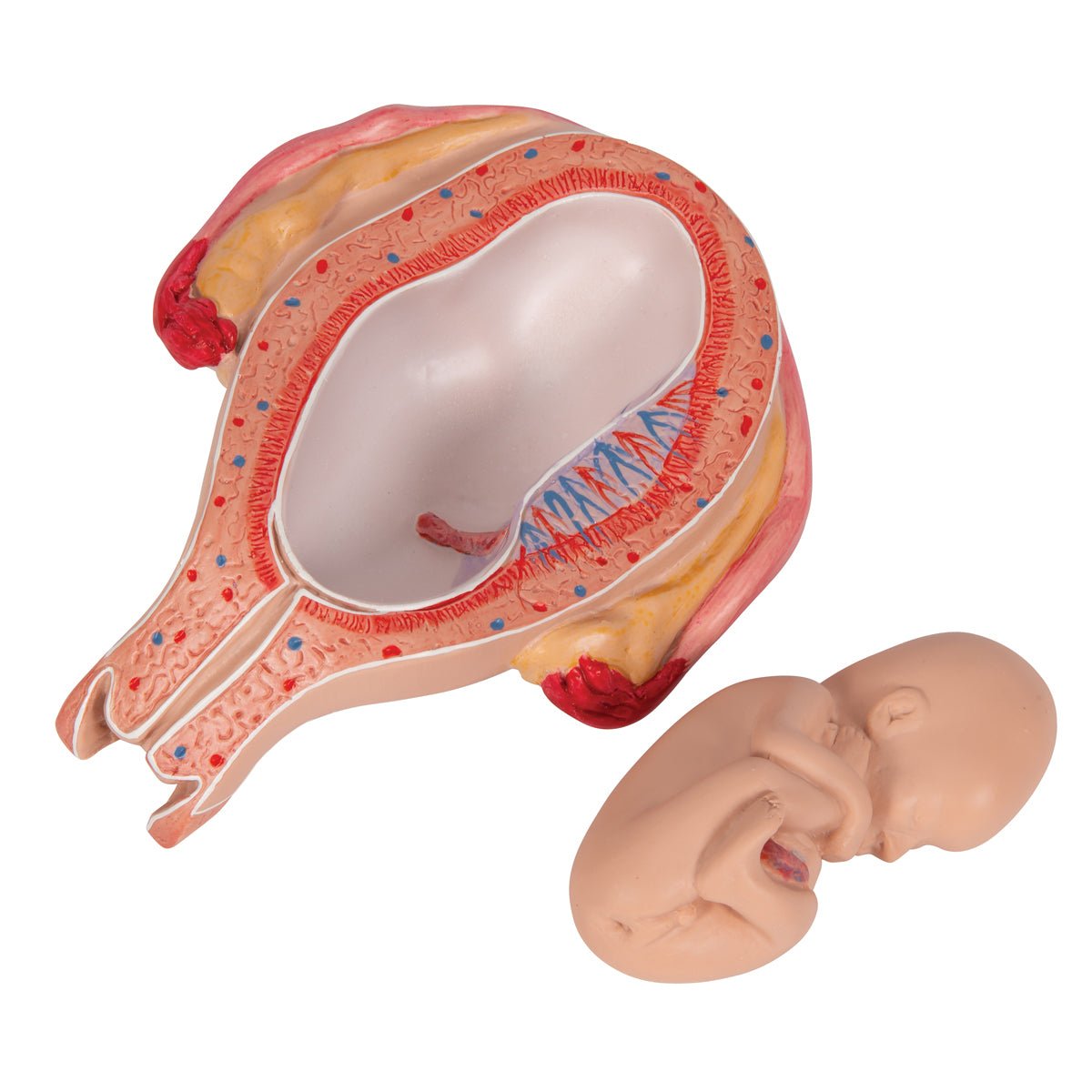 5-Month Fetus in Breech Position - Realistic Pregnancy Model for Medical Education & Training | Perfect for Obstetrics Students, Doctors & Midwives