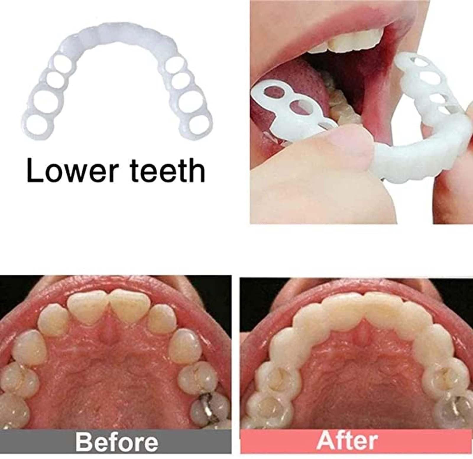 Natural & Comfortable Temporary Fake Teeth for Women & Men - Cosmetic Denture Veneers for Upper & Lower Jaw to Regain Confident Smile | Perfect for Parties, Weddings, and Daily Wear