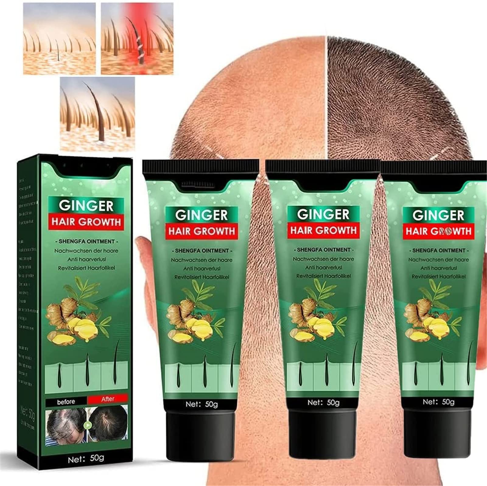 BIERDAN Hair Growth Cream - Natural Ginger Hair Growth Ointment for Men & Women | Anti-Hair Loss Treatment for Thinning Hair & Scalp Care | Promotes Hair Regrowth for Thicker, Fuller Hair - Perfect for Daily Hair Care Routine & Styling Prep