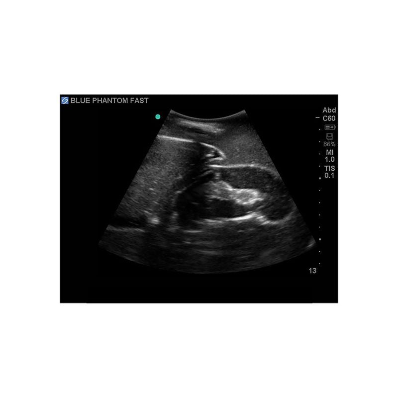 FAST Exam Ultrasound Training Model - Transthoracic & Transesophageal Echo Simulator for Cardiac Sonography Practice (Ideal for Medical Students, Ultrasound Tech Training & Clinical Skills Development)