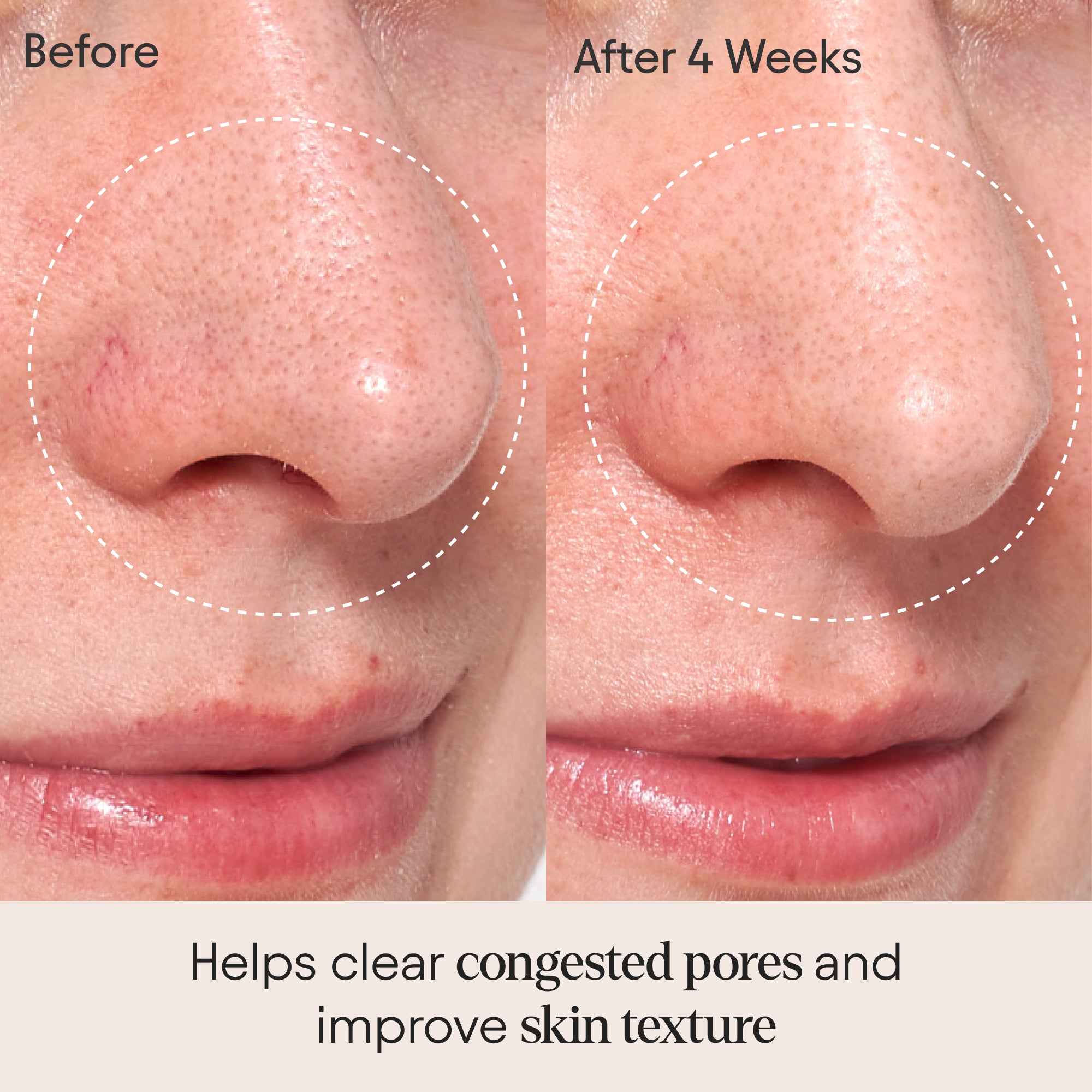 Clarifying Facial Oil with Retinol & Pink Algae - Anti-Aging, Brightening & Hydrating Skincare for Glowing Skin - Perfect for Night Routine & Dry Skin Care