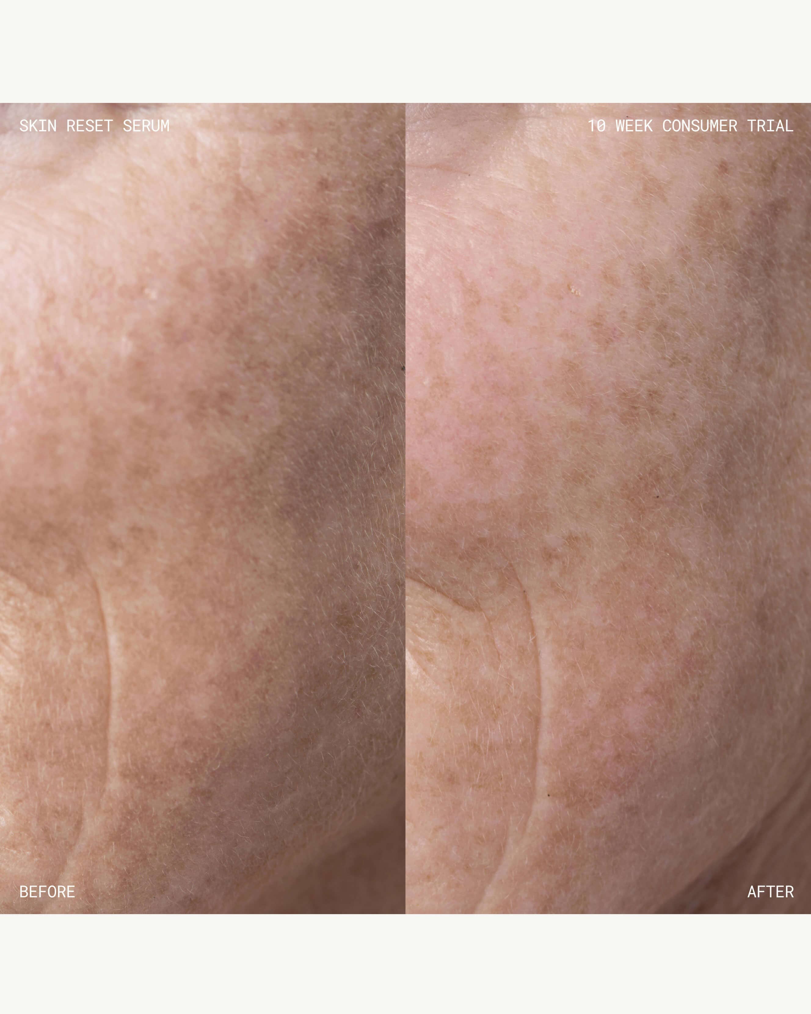 Skin Reset Serum Refill - Anti-Aging Facial Treatment for Glowing Skin | Perfect for Night Routine & Daily Hydration