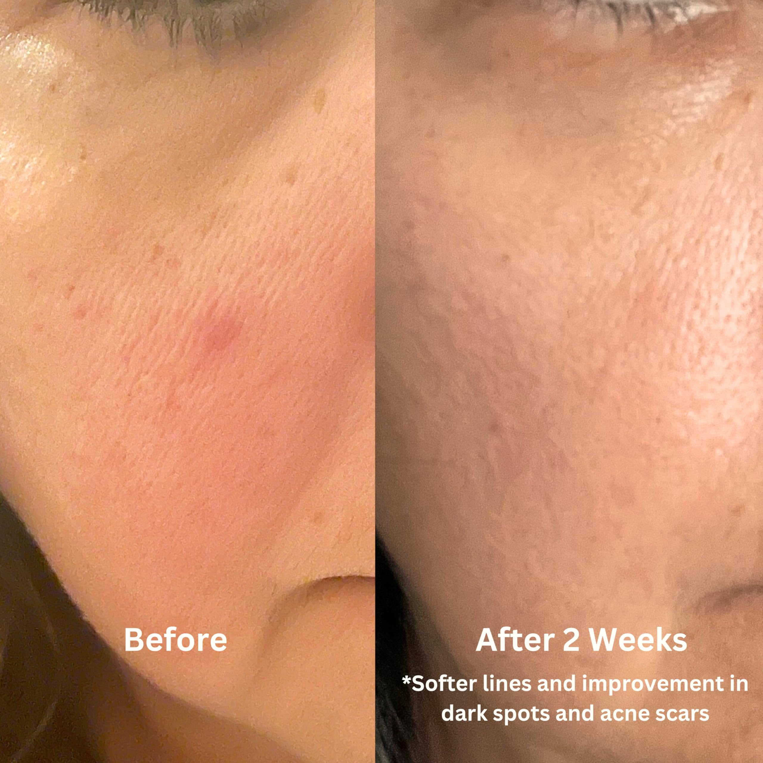 Luster Bakuchiol Oil Serum - Natural Retinol Alternative for Anti-Aging | Superfood Face Oil with Bakuchiol, Astaxanthin, Rosehip & Pomegranate Oils | Hydrating & Brightening Skincare for Daily Use
