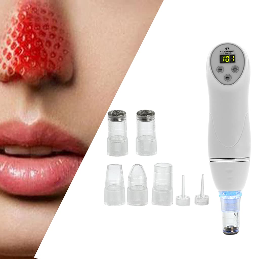 Professional Losa Blackhead Remover Tool - Deep Cleansing Pore Vacuum for Face & Nose - Acne Extractor & Blackhead Suction Kit - Perfect for Daily Skincare & Spa Treatments