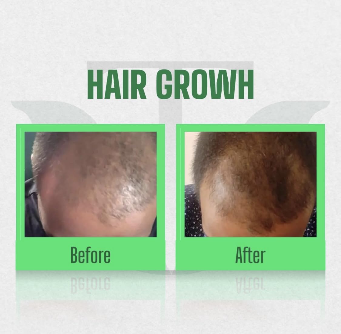 Vikash Thailas Advance Herbal Hair Oil 300ml - Natural Hair Growth Treatment for Dry, Damaged Hair - Perfect for Daily Scalp Massage & Hair Care Routine