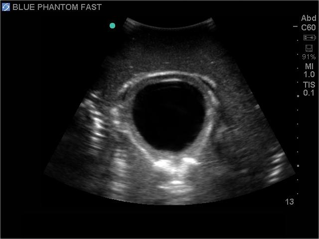 FAST Exam Real Time Ultrasound Training Model - Transthoracic Only for Emergency Medicine & Trauma Assessment Practice (Medical Simulation, Sonography Education, TTE Training)