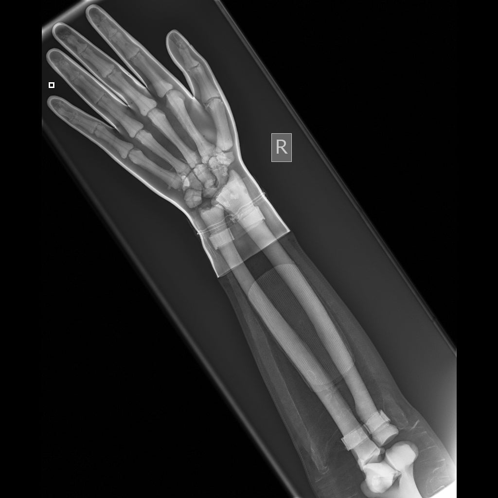 Full Body X-Ray and Radiographic Positioning Manikin - Professional Medical Training Model for Radiology Students & Technicians - Perfect for Classroom, Lab & Clinical Practice