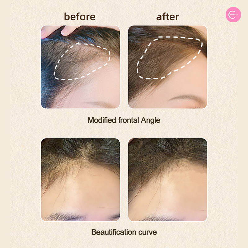 WonderBeige Fantasy Hairline Powder for Thinning Hair - Natural Hair Thickening Fibers for Men & Women - Perfect for Daily Use & Special Occasions