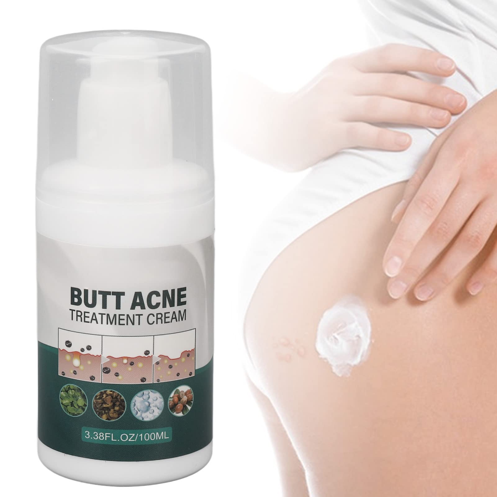 Best Buttock Pimple Treatment Cream - Acne Cleansing & Skin Moisturizing Repair for Thigh & Butt Area | Prevent & Soothe Breakouts for Smooth Skin | Perfect for Post-Workout, Travel & Daily Care