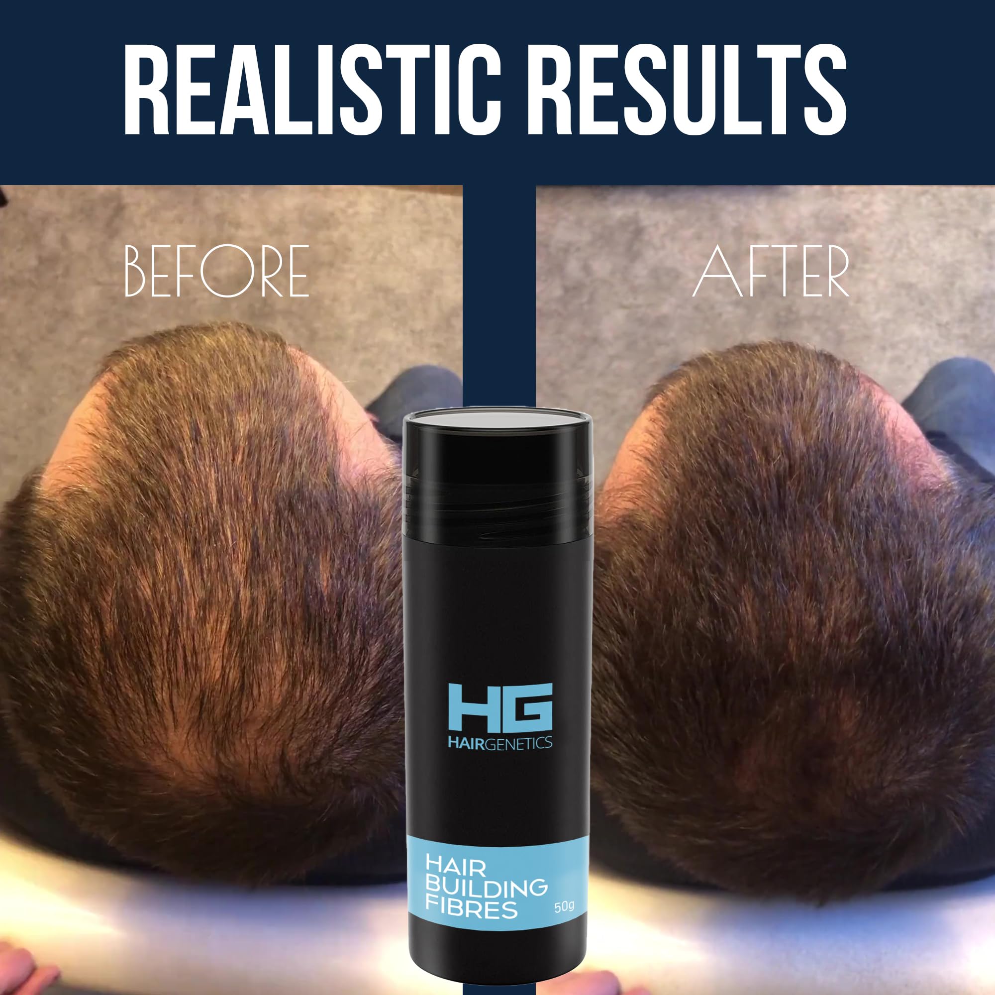 Medium Brown Hair Fibers for Hair Loss - 22g Hair Thickening Fibers for Men & Women - Covers Thin Hair & Bald Spots - Natural-Looking Hair Fibers for Thicker Fuller Hair - Perfect for Daily Use, Work, and Special Occasions