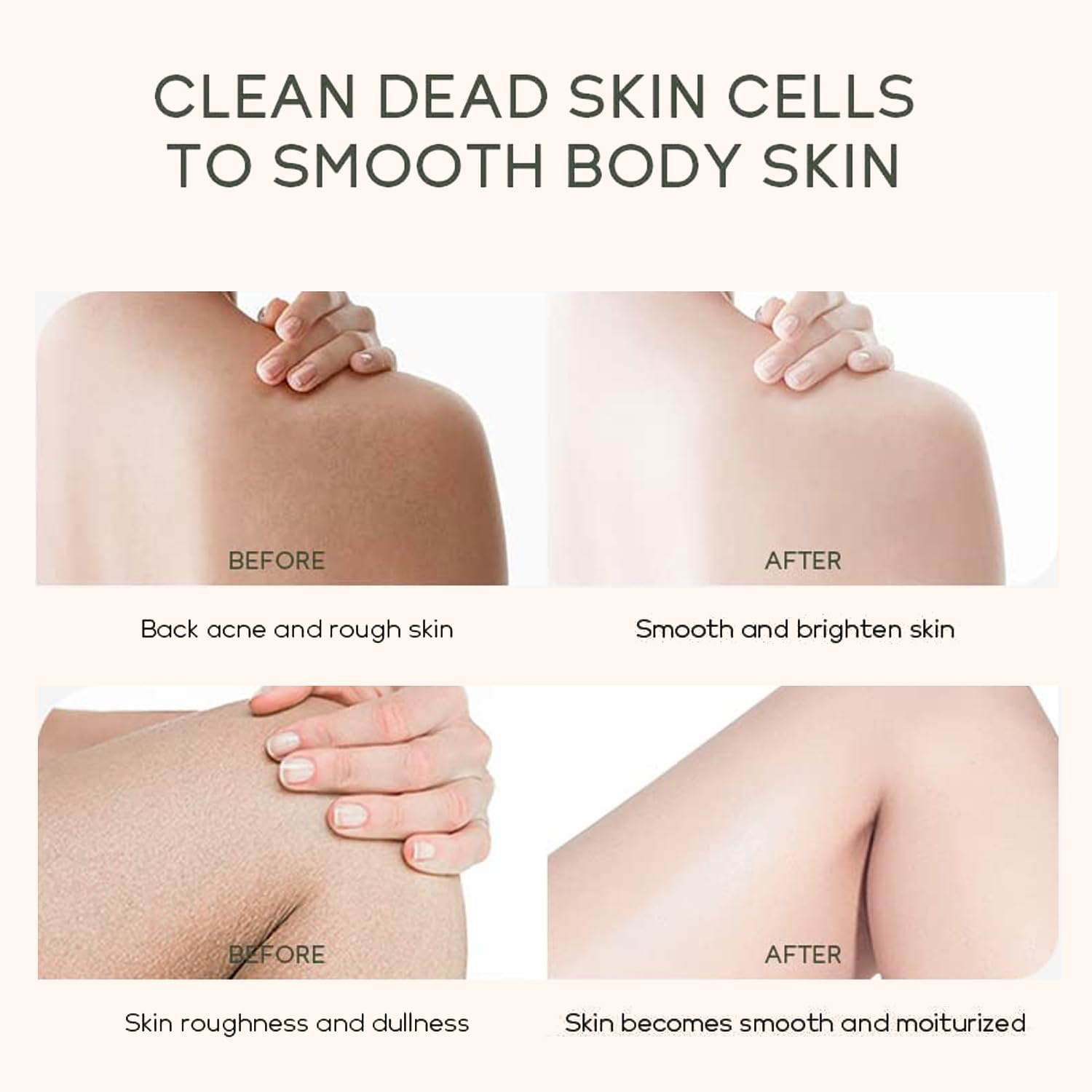 Niacinamide Body Scrub for Dark Spots & Acne Scars - Brightening Exfoliator for Large Pores & Uneven Skin Tone | Deep Hydration & Skin Renewal | 8.8oz Gentle Body Polish for Smooth, Glowing Skin | Perfect for Post-Workout & Pre-Tanning Skincare Routine