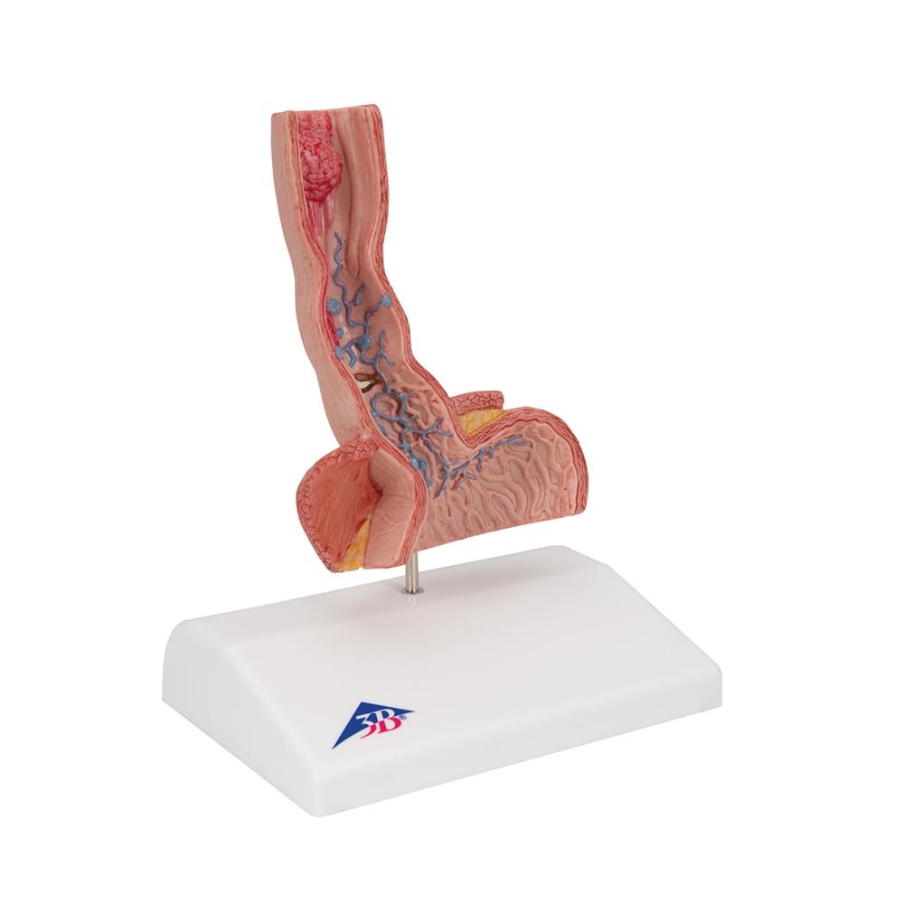 Human Esophagus Anatomy Model - Detailed Medical Teaching Tool for Digestive System Study | Ideal for Students, Doctors & Healthcare Professionals