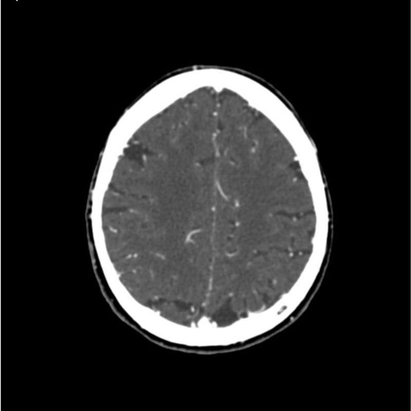 Professional CTA Head and Neck Phantom - High-Quality CT Scan & X-Ray Training Model for Medical Education | Perfect for Radiology Students, Technicians & Clinical Practice