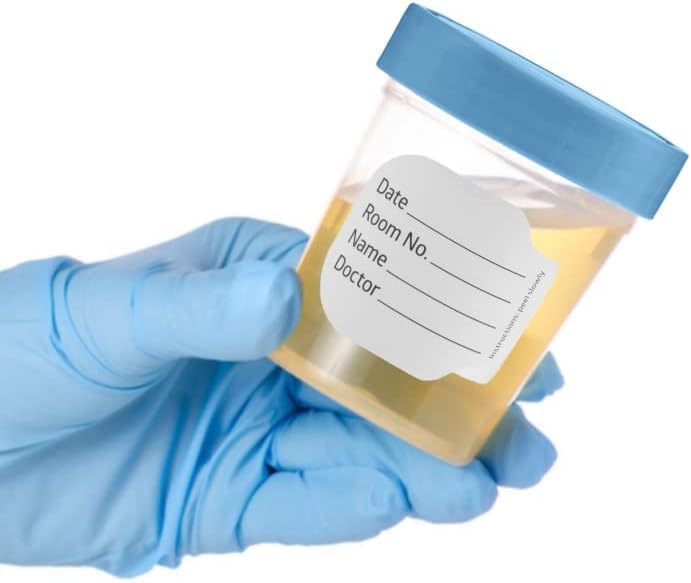 20 Pack 4oz Clear Specimen Cups with Leak-Proof Screw Lids - Non-Sterile Urine, Stool & Semen Sample Collection Containers for Medical Testing - Perfect for Home, Clinic & Lab Use