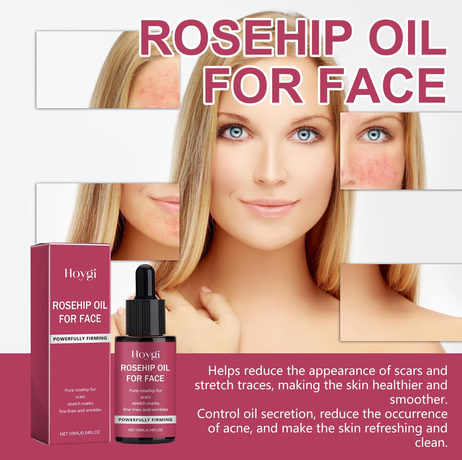Pure Rosehip Essential Oil for Face, Hair & Body - 100% Natural Skin Nourishing Oil with Deep Moisturizing Benefits | Perfect for Dry Skin Care, Anti-Aging Routine & Nighttime Hydration