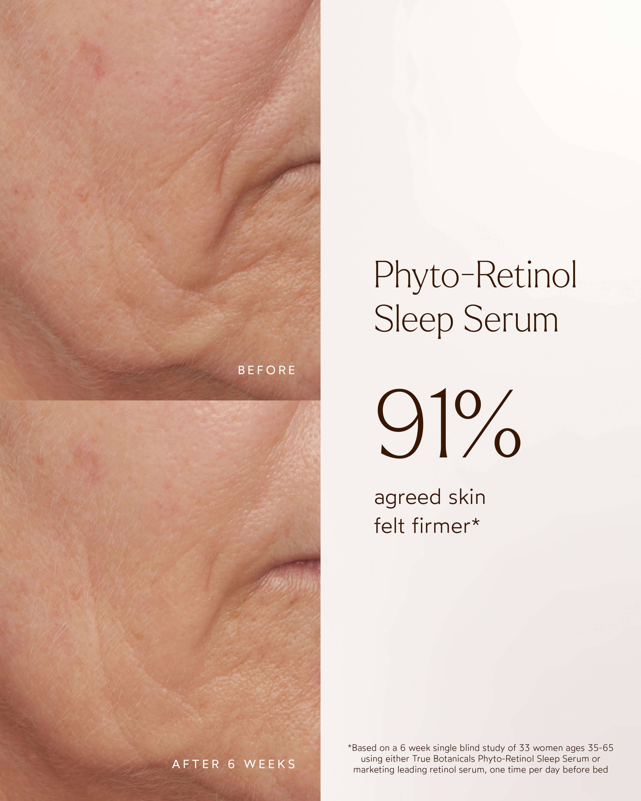 Phyto Retinol Anti-Aging Night Serum for Wrinkles & Fine Lines | Hydrating Overnight Face Treatment for Youthful Skin | Perfect for Nighttime Skincare Routine