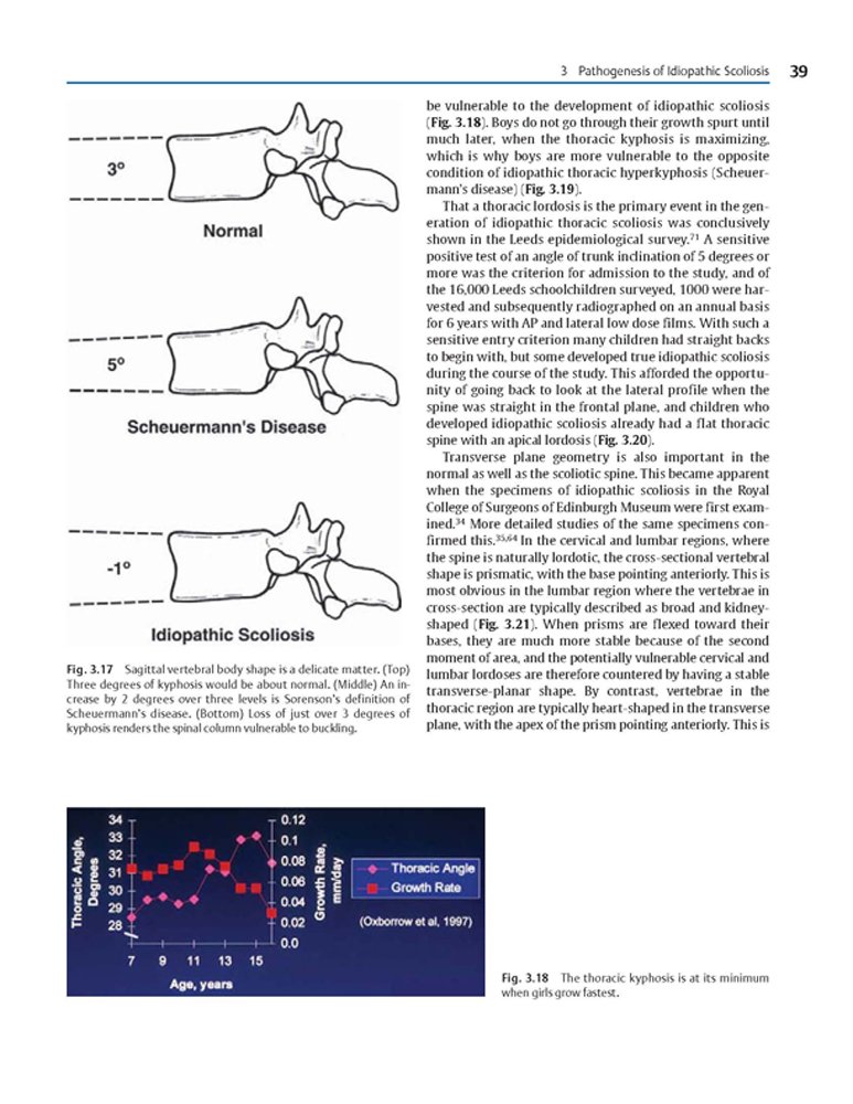 Idiopathic Scoliosis Treatment Guide - Harms Study Group Recommendations for Spinal Correction & Pain Relief | For Doctors, Physical Therapists & Patients