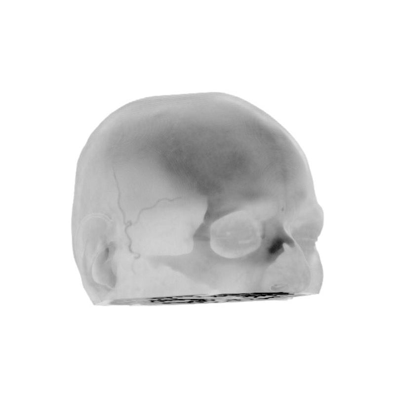 CTA Aneurysm Head Phantom for CT Scan and X-Ray Training - High-Quality Medical Simulation Tool for Radiology Education and Diagnostic Practice