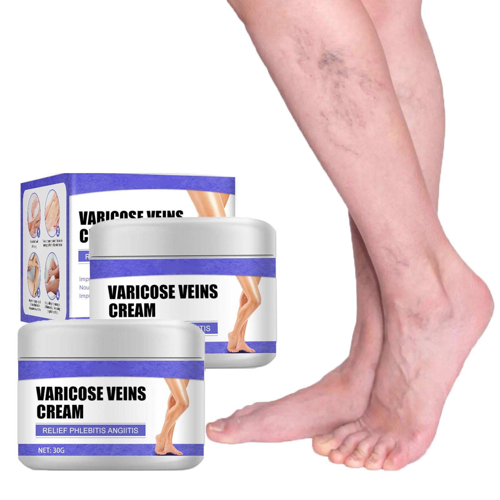 Premium New Zealand Varicose Veins Relief Cream - Natural Leg Vein Treatment for Spider & Varicose Veins - Soothes Aching Legs & Improves Circulation - Perfect for Office Workers, Travelers & Active Lifestyles
