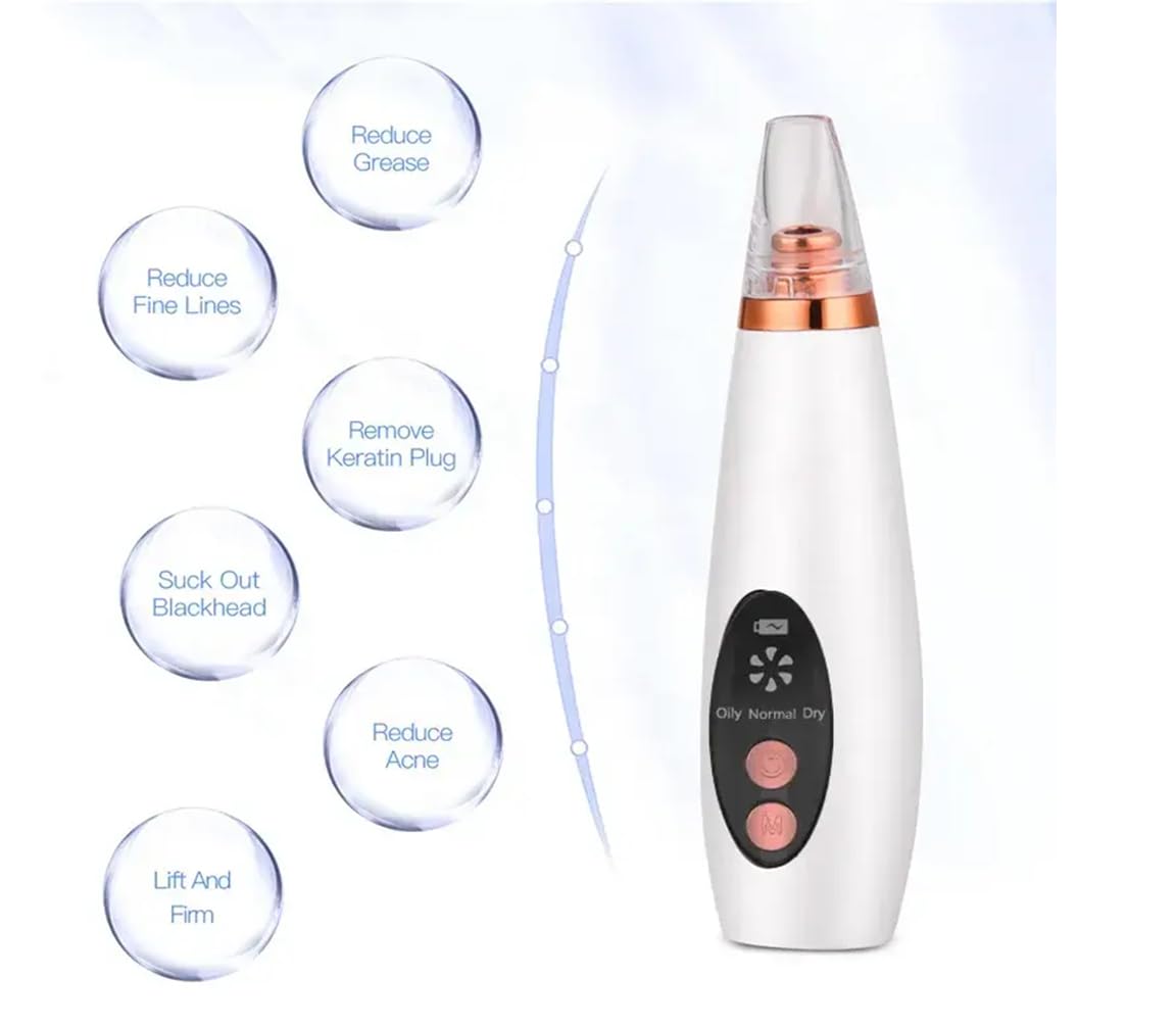 Lukzer Expert Electric Blackhead Remover Vacuum - Professional Derma Suction Tool for Face Cleansing | Men & Women Skincare Device (White) | Perfect for Acne Treatment & Deep Pore Cleaning at Home