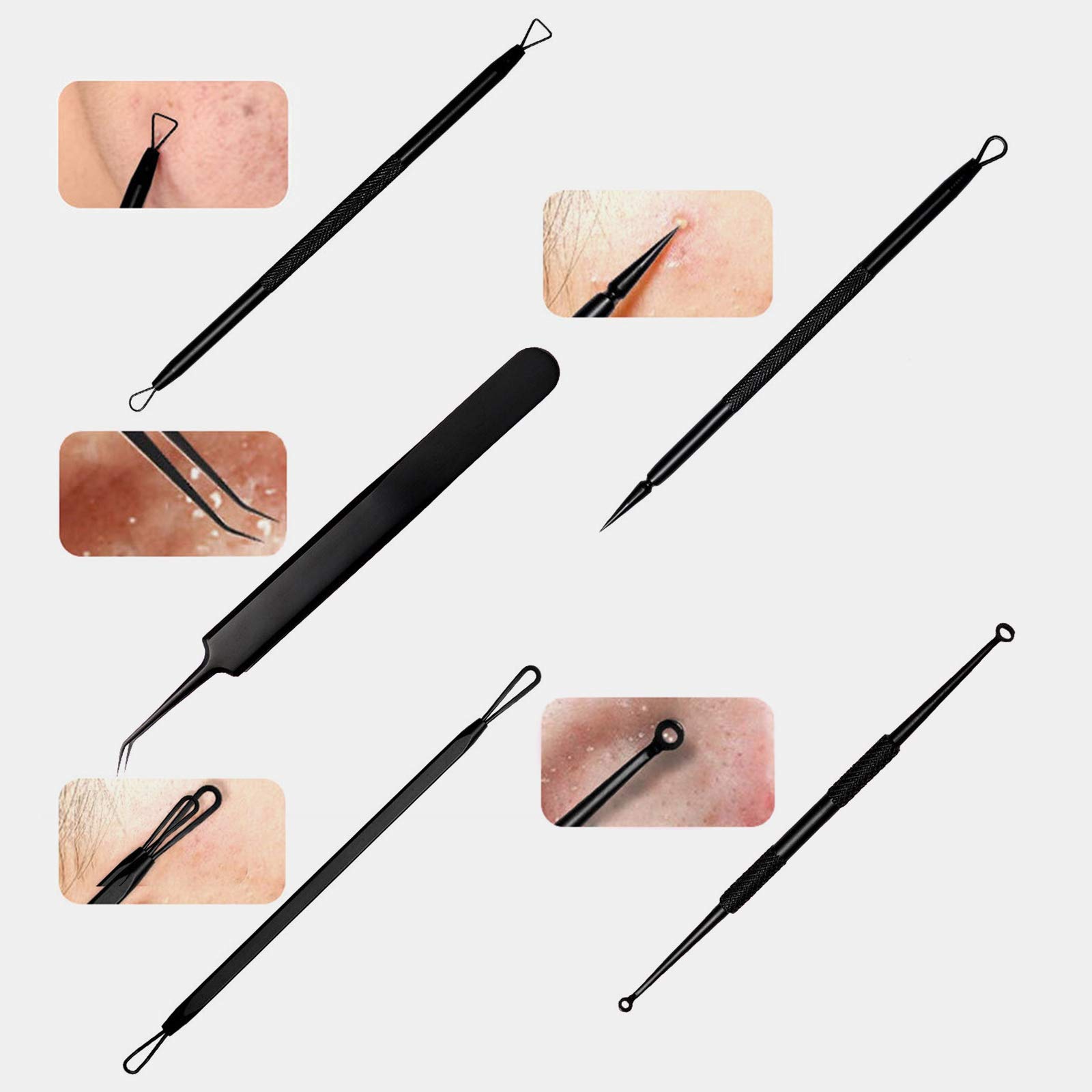 11-Piece Blackhead Remover Kit - Professional Pimple Popper Tool & Acne Extractor Set for Blackheads & Whiteheads - Perfect for Home Skincare & Facial Treatment