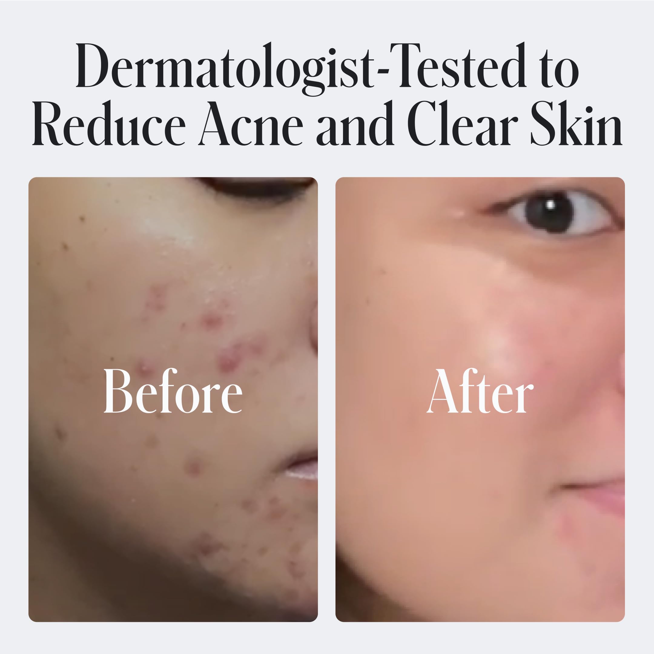 Geologie 2% Salicylic Acid Face Wash with Bergamot & Juniper - Oil Control & Acne Treatment Facial Cleanser for Men & Women | Deep Cleansing BHA Exfoliator | 2-Pack | Perfect for Daily Skincare & Post-Workout Refresh