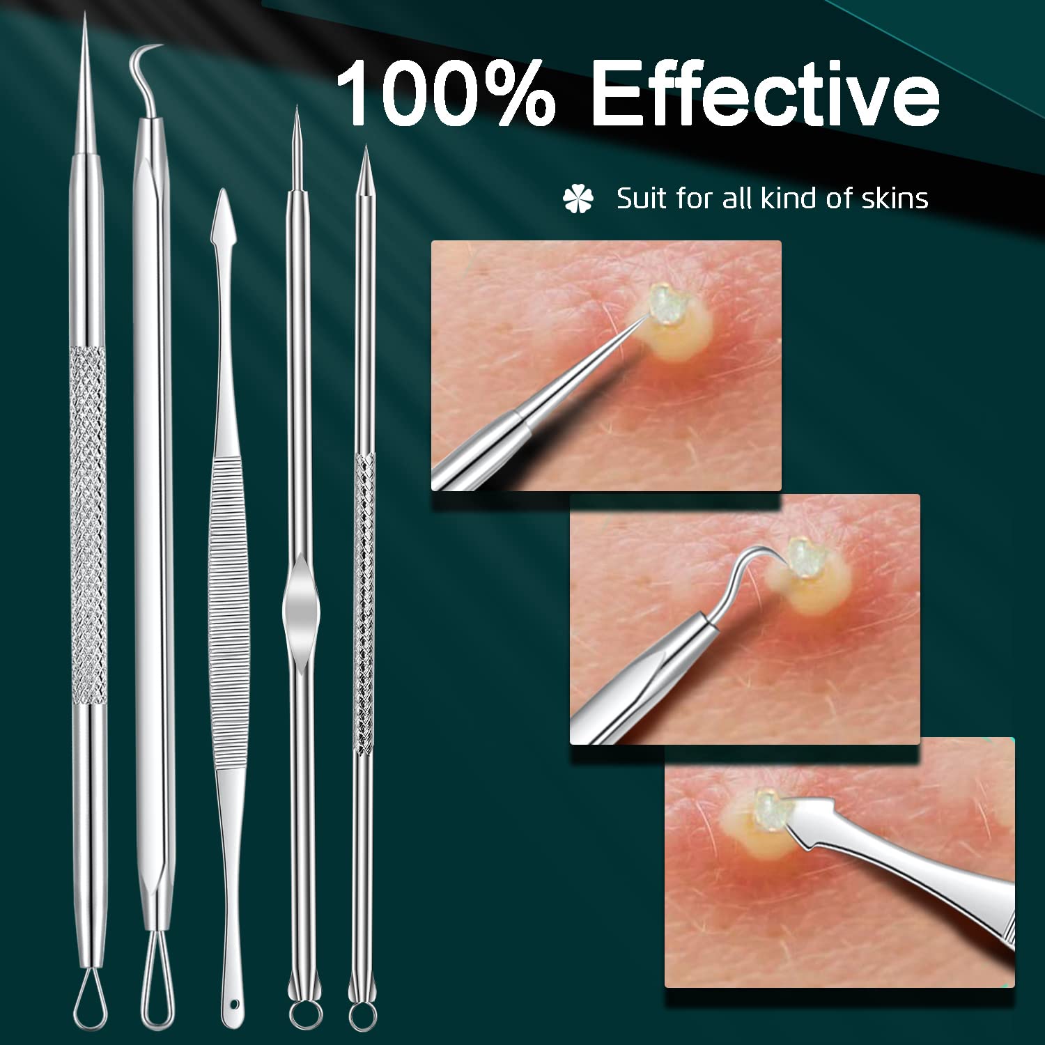 Professional Blackhead & Pimple Remover Tool Kit - Acne Comedone Extractor for Nose & Face Skin Care - Comes with Travel Case - Perfect for Home Spa & Dermatologist-Recommended Skin Treatment