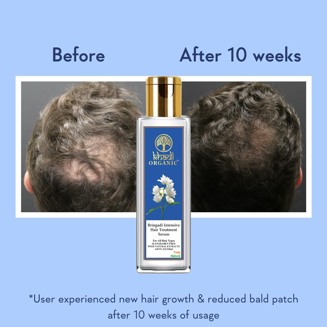 Khadi Organic Bringadi Intensive Hair Treatment Serum 120ML - Natural Hair Growth Oil for Thicker Hair & Scalp Nourishment | Ayurvedic Remedy for Hair Fall Control & Dandruff Relief | Perfect for Daily Hair Care Routine & Damaged Hair Repair