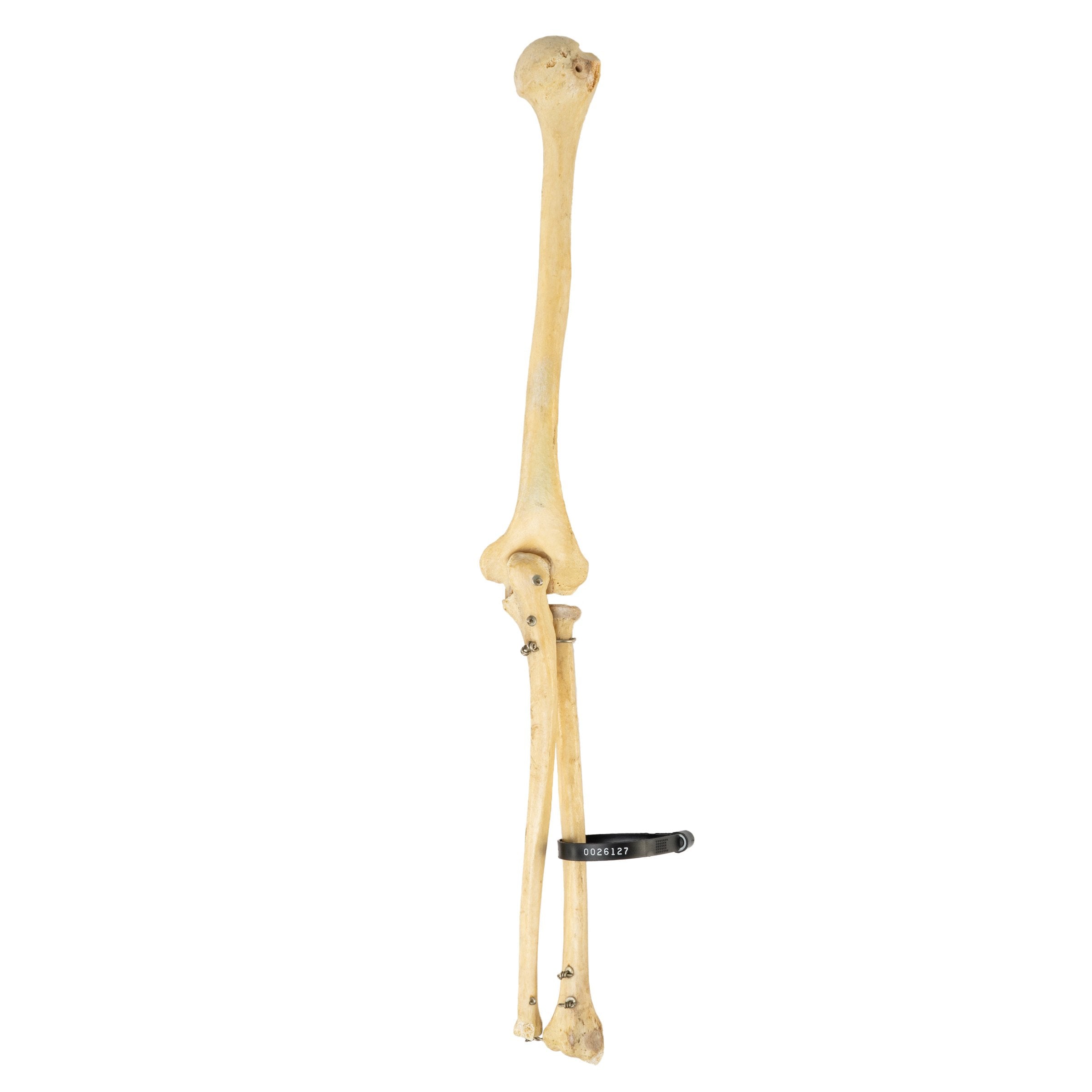 Authentic Human Humerus, Radius & Ulna Bones - Medical Study, Anatomy Education & Science Classroom Specimen
