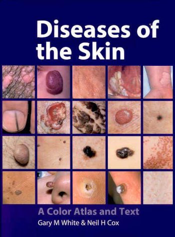 Diseases of the Skin: Color Atlas & Textbook - Comprehensive Dermatology Guide for Medical Students & Professionals | Clinical Reference & Diagnosis Tool
