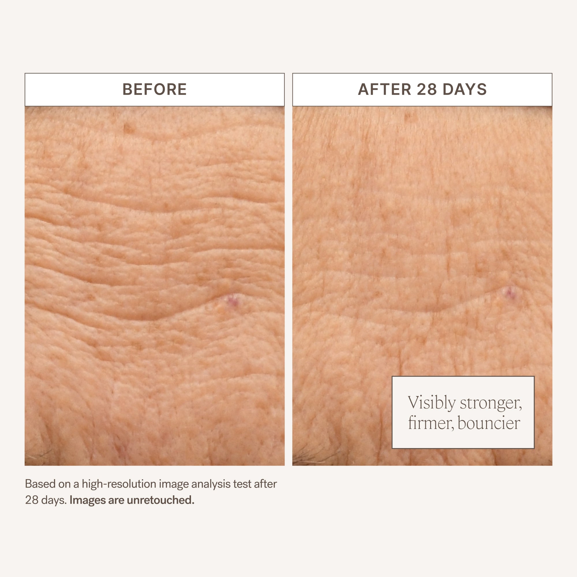 Barrier Build Skin Protectant Cream for Eczema & Dry Skin Relief - Dermatologist Recommended Moisturizing Lotion for Sensitive Skin Care - Ideal for Daily Use, After Shower & Nighttime Hydration