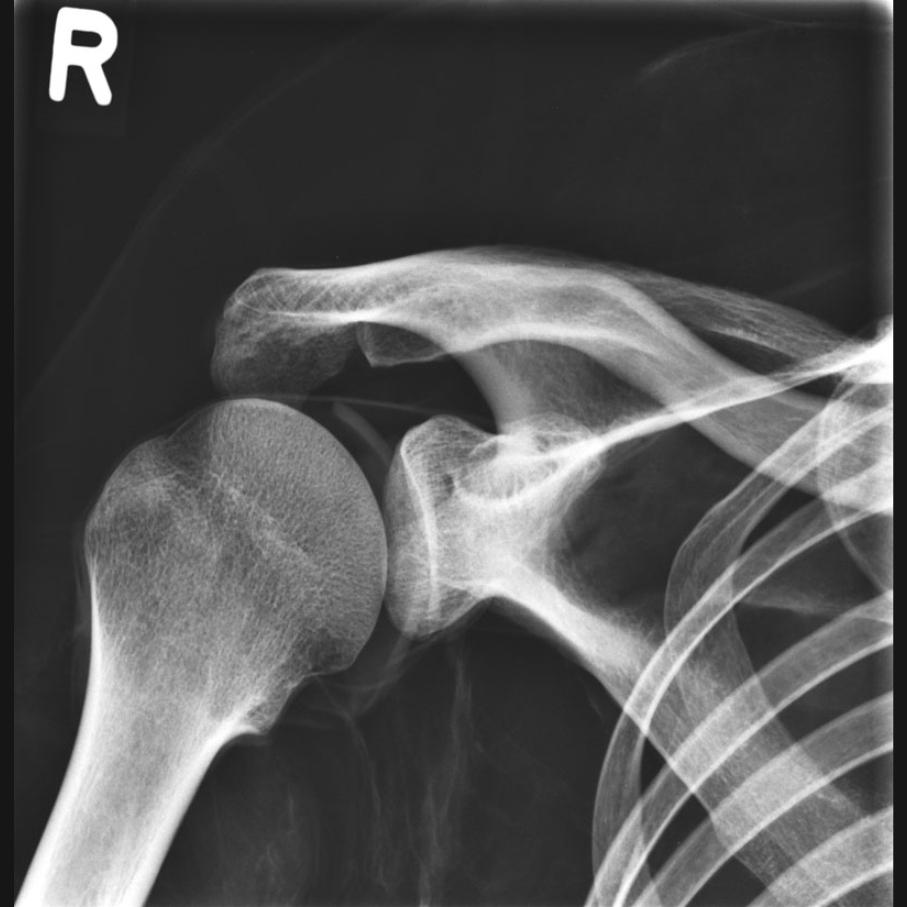 Full Body X-Ray Phantom with Real Human Skeleton Bones - High-Quality Medical Training Model for Radiology, Anatomy Studies & X-Ray Positioning Practice (Ideal for Medical Schools, Hospitals & Research Labs)