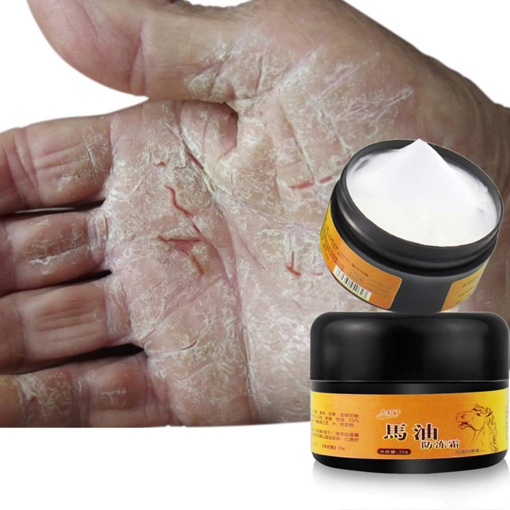 Allbestaye Horse Oil Foot Cream for Dry Cracked Heels - Intensive Repairing Moisturizer for Rough & Chapped Feet - Best for Cracked Heel Treatment & Foot Care at Night