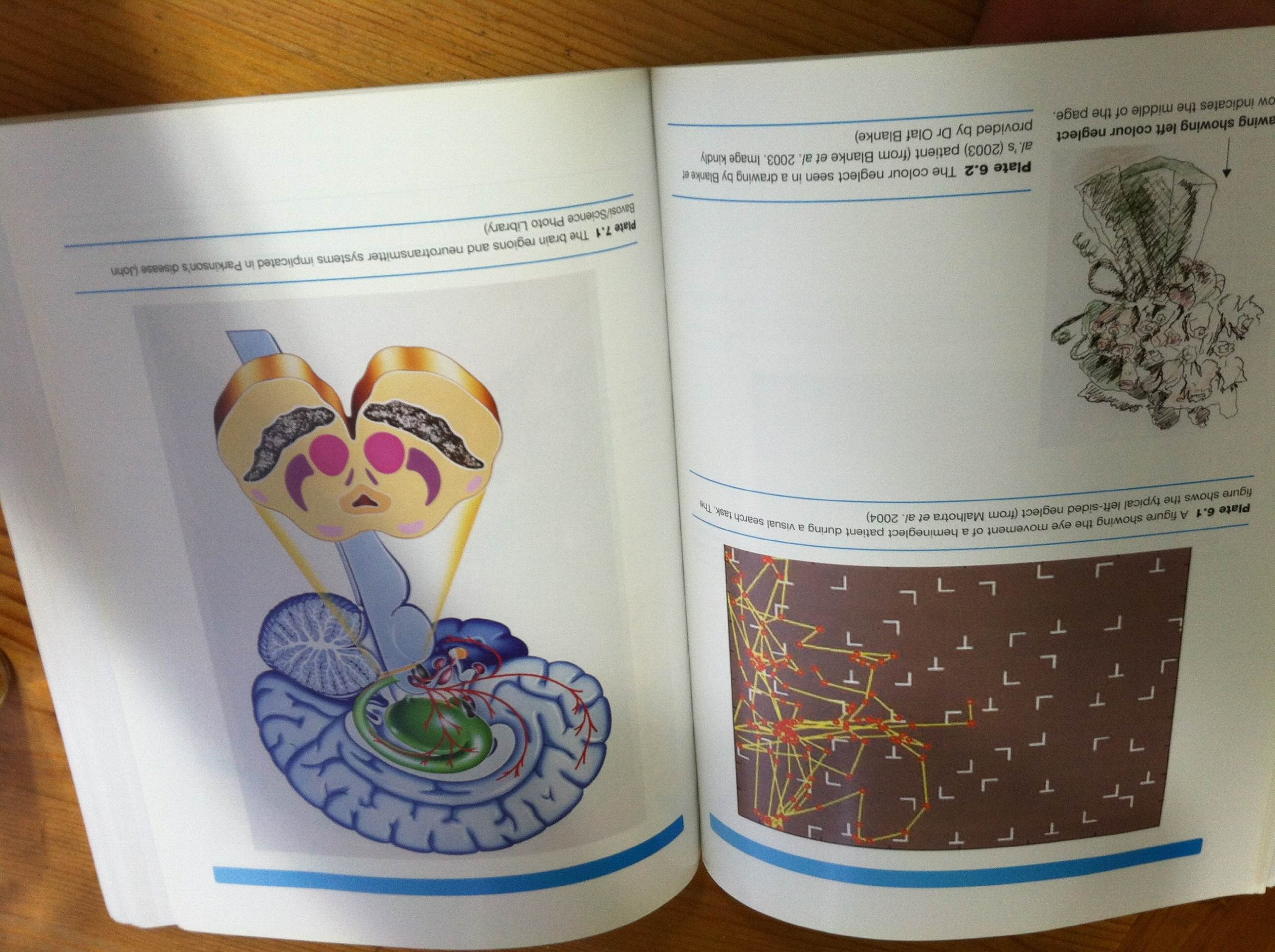 Human Neuropsychology 2nd Edition - Comprehensive Textbook for Neuroscience & Psychology Students | Perfect for Academic Study & Research
