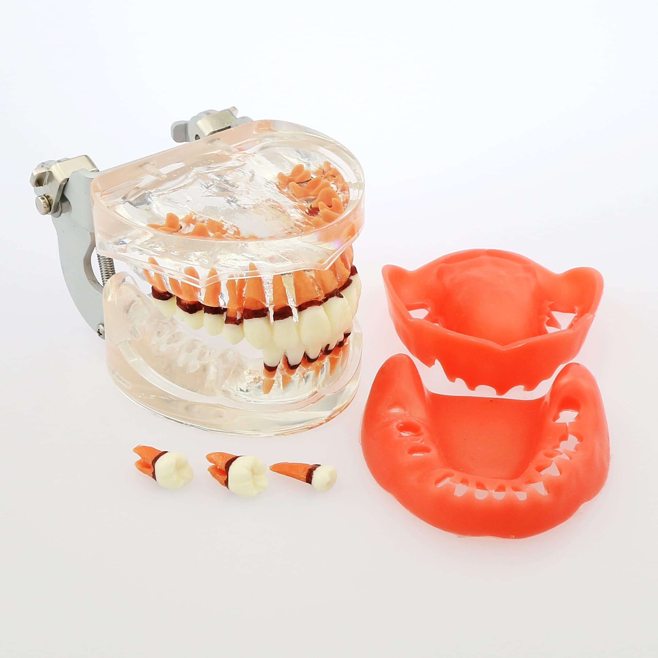 Adult Transparent Dental Teeth Model - Removable Gingivae for Pathology Study & Teaching - Perfect for Dental Students, Dentists & Medical Professionals