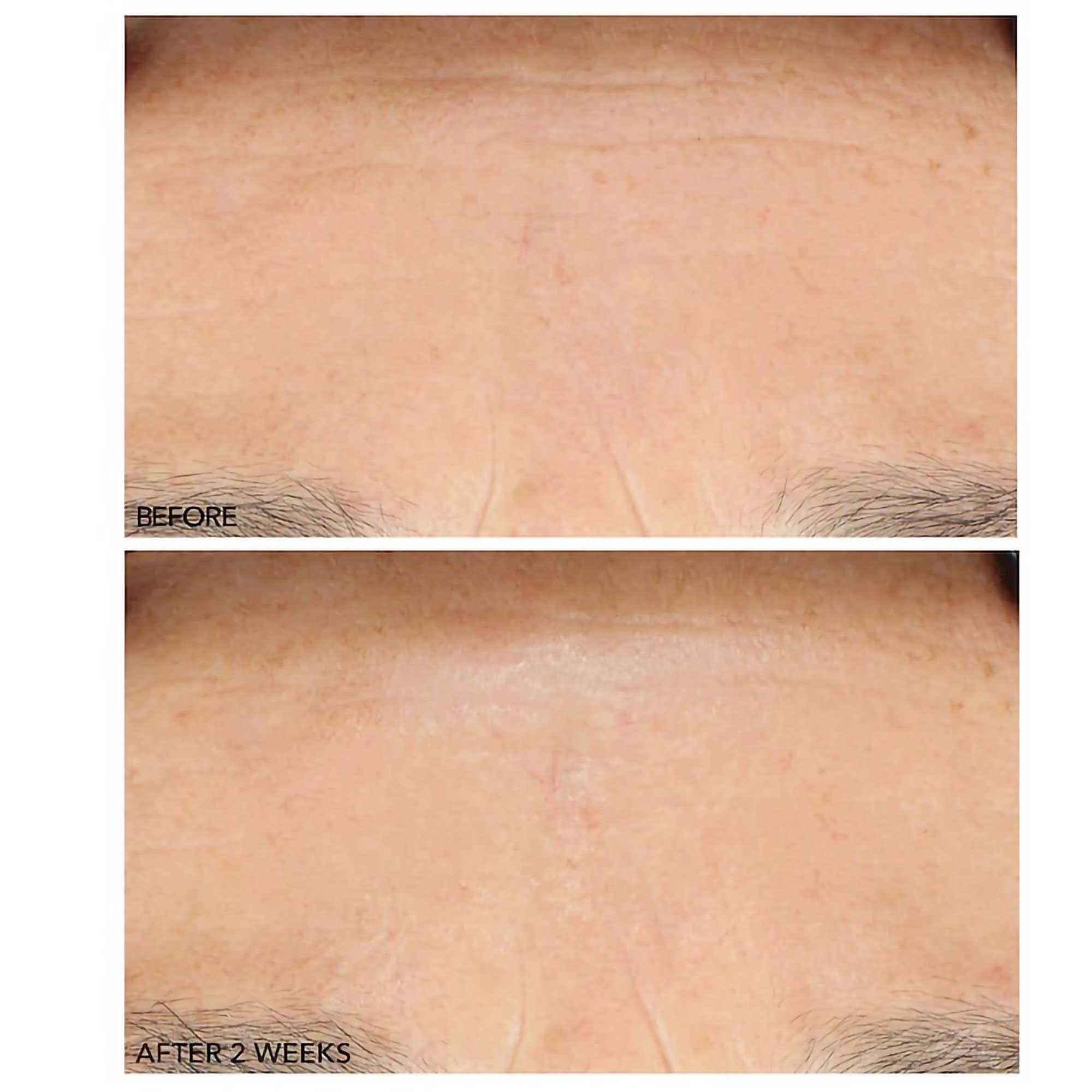 Dr. Dennis Gross Alpha Beta Advanced Liquid Peel 2-Step Exfoliating Treatment for Face - Brightens Skin & Reduces Wrinkles | Perfect for Daily Skincare Routine & Pre-Makeup Prep