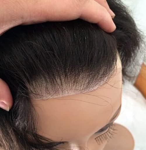 Premium AHS Men's Hair Patch for Baldness & Hair Loss | 100% Natural Human Hair Front Hair System | Receding Hairline Solution for Men & Boys | Straight Hair Patch for Daily Wear & Special Occasions (Pack of 1) | Perfect for Work, Dating & Social Events