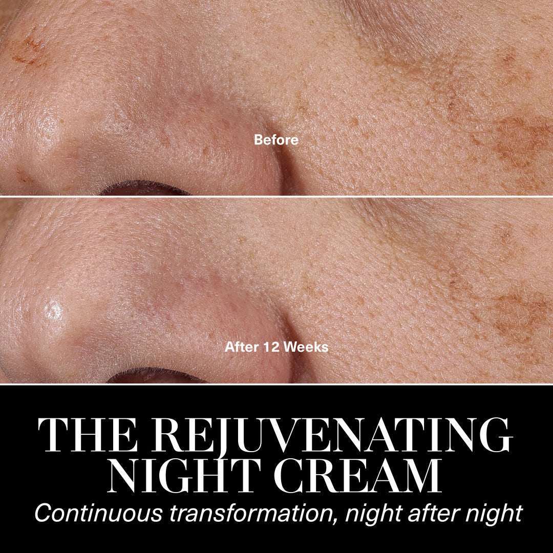 Day and Night Moisturizing Duet - Hydrating Face Cream Set for Dry & Sensitive Skin | Perfect for AM/PM Skincare Routine & Travel