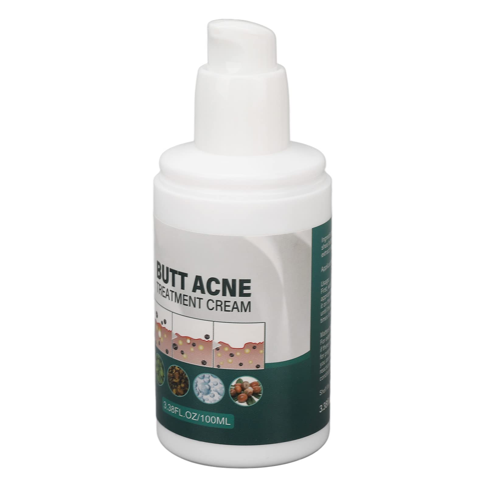 Best Buttock Pimple Treatment Cream - Acne Cleansing & Skin Moisturizing Repair for Thigh & Butt Area | Prevent & Soothe Breakouts for Smooth Skin | Perfect for Post-Workout, Travel & Daily Care